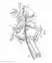 Fig. 11 - Surgical access system and related methods