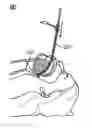 Fig. 01 - INTUBATION METHODS AND SYSTEMS