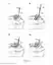 Fig. 05 - INTUBATION METHODS AND SYSTEMS