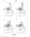 Fig. 07 - INTUBATION METHODS AND SYSTEMS