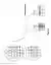 Fig. 07 - Hyperspectral technology for assessing and treating diabetic foot and tissue disease