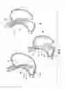 Fig. 05 - Devices and methods facilitating sleeve gastrectomy procedures
