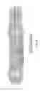 Fig. 32 - Method and apparatus for stabilizing, straightening, expanding and/or flattening the side wall of a body lumen and/or body cavity so as to provide increased visualization of the same and/or increased access to the same, and/or for stabilizing instruments relative to the same