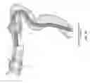 Fig. 35 - Method and apparatus for stabilizing, straightening, expanding and/or flattening the side wall of a body lumen and/or body cavity so as to provide increased visualization of the same and/or increased access to the same, and/or for stabilizing instruments relative to the same
