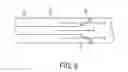 Fig. 06 - Selectively delivering particles into the distal portion of the left gastric artery