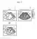 Fig. 07 - ULTRASONIC DIAGNOSTIC APPARATUS AND ELASTIC EVALUATION METHOD