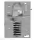 Fig. 08 - PEDIATRIC SALIVA SAMPLE COLLECTION SYSTEM