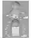 Fig. 09 - PEDIATRIC SALIVA SAMPLE COLLECTION SYSTEM