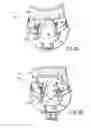 Fig. 08 - CERVICAL COLLAR WITH INDEPENDENT HEIGHT AND CIRCUMFERENCE ADJUSTABILITY