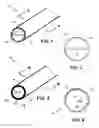 Fig. 02 - Bio-compatible catheter