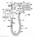 Fig. 01 - SUCTION CATHETER WITH DISTAL SUCTION MODULATION