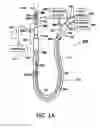 Fig. 02 - SUCTION CATHETER WITH DISTAL SUCTION MODULATION