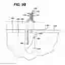 Fig. 07 - High strength suture with absorbable core and suture anchor combination