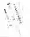 Fig. 13 - INJECTING DEVICE WITH DOSE RESETTING MECHANISM