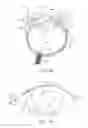 Fig. 02 - Ocular insert apparatus and methods