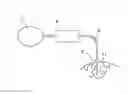 Fig. 01 - Closed loop system for controlling the reflux of a fluid injection