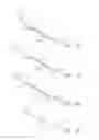 Fig. 04 - Method and devices for flow occlusion during device exchanges