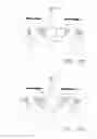 Fig. 41 - Method and devices for flow occlusion during device exchanges