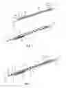 Fig. 06 - Method of indwelling a needle assembly