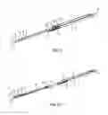 Fig. 07 - Method of indwelling a needle assembly