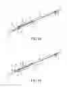 Fig. 13 - Method of indwelling a needle assembly