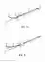 Fig. 14 - Method of indwelling a needle assembly