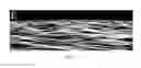 Fig. 05 - Corneal vitrification, methods and devices to produce corneal vitrification and methods of use thereof