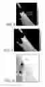 Fig. 05 - Skin treatment method and apparatus