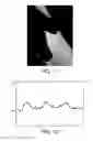 Fig. 06 - Skin treatment method and apparatus