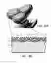 Fig. 09 - Skin treatment method and apparatus