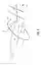 Fig. 06 - Integrated Suture and Cauterization