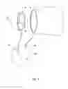 Fig. 02 - Electrosurgical colpotomy device