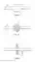 Fig. 07 - Electrosurgical colpotomy device