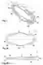 Fig. 02 - FIXING DEVICE FOR FIXING THE FRACTURE ENDS OF THE BONES IN A BONE FRACTURE, AND TENSIONING ELEMENT, ANGLE CLAMPING SLEEVE AND CORRESPONDING METHOD