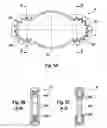 Fig. 04 - FIXING DEVICE FOR FIXING THE FRACTURE ENDS OF THE BONES IN A BONE FRACTURE, AND TENSIONING ELEMENT, ANGLE CLAMPING SLEEVE AND CORRESPONDING METHOD