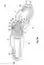 Fig. 09 - FIXING DEVICE FOR FIXING THE FRACTURE ENDS OF THE BONES IN A BONE FRACTURE, AND TENSIONING ELEMENT, ANGLE CLAMPING SLEEVE AND CORRESPONDING METHOD