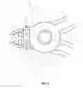 Fig. 07 - Staples for generating and applying compression within a body