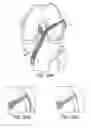 Fig. 20 - Drill pin for fixation of ligaments using button/loop construct