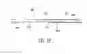 Fig. 27 - Intraocular shunt inserter