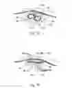 Fig. 08 - Vaginal cuff closure tool and method