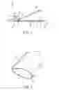 Fig. 02 - Devices and methods for removal of calculus