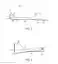 Fig. 03 - Devices and methods for removal of calculus