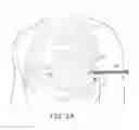 Fig. 05 - Open channel implant tools and implant techniques utilizing such tools