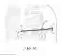 Fig. 07 - Open channel implant tools and implant techniques utilizing such tools