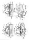 Fig. 06 - SUTURING DEVICE FOR LAPAROSCOPIC PROCEDURES