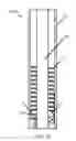 Fig. 04 - Surgical fastener