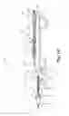 Fig. 03 - Rotational atherectomy device with exchangeable drive shaft and meshing gears
