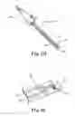 Fig. 05 - Rotational atherectomy device with exchangeable drive shaft and meshing gears