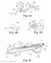 Fig. 10 - Rotational atherectomy device with exchangeable drive shaft and meshing gears