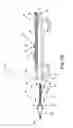 Fig. 03 - Rotational atherectomy device with exchangeable drive shaft and meshing gears